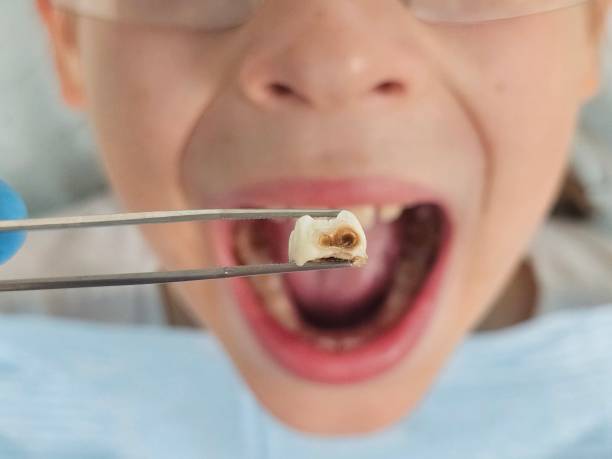 Best Same-Day Emergency Dental Services in Lake Camelot, WI