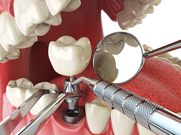 Best Emergency Dental Care for Broken or Chipped Teeth in Lake Camelot, WI